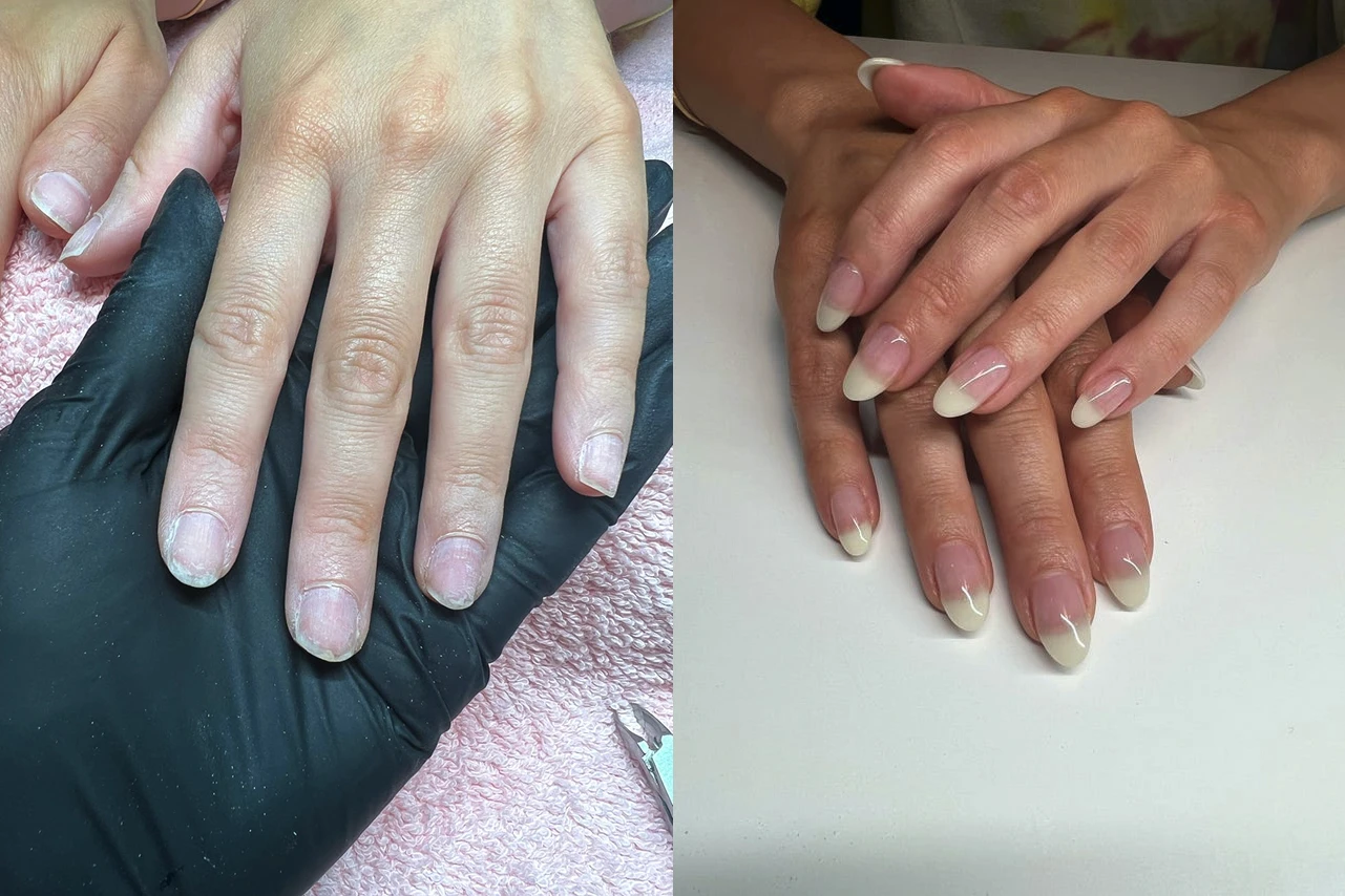 Гелевое восстановление ногтей